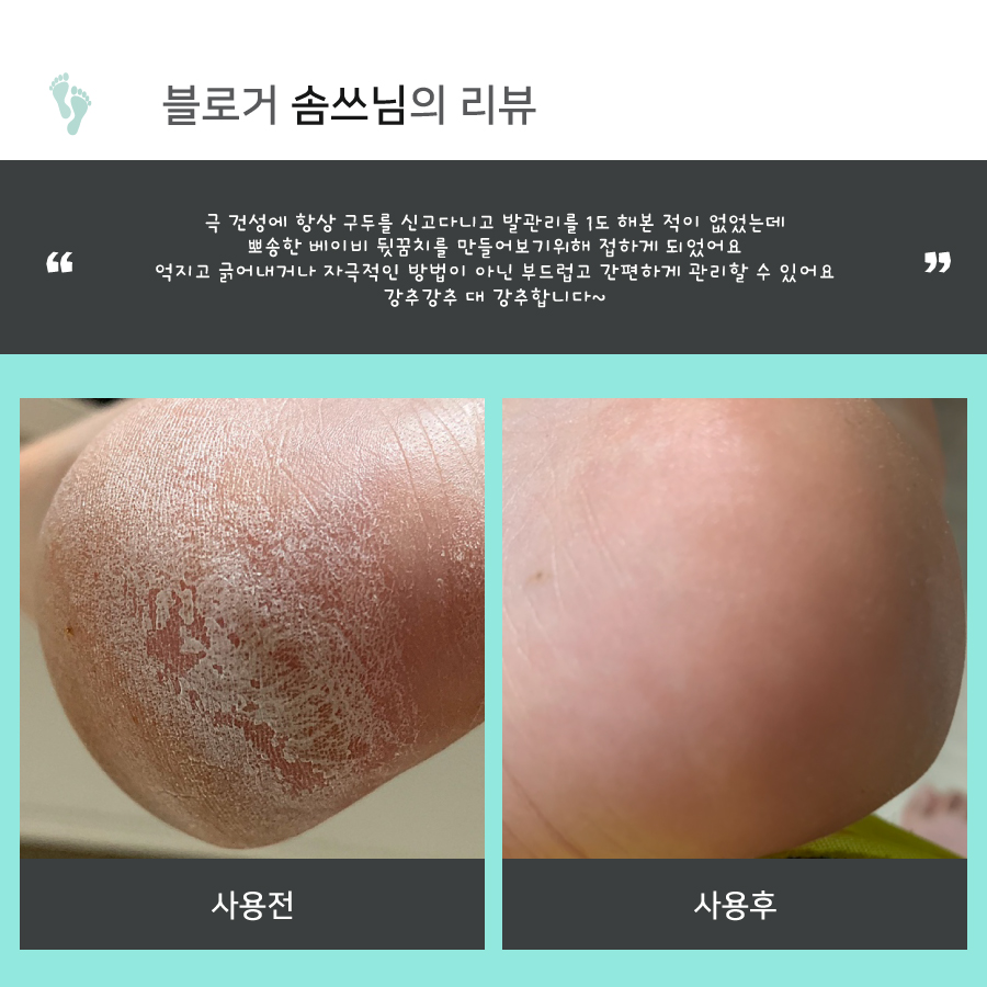 lupine_rubbing_foot_j_25.jpg